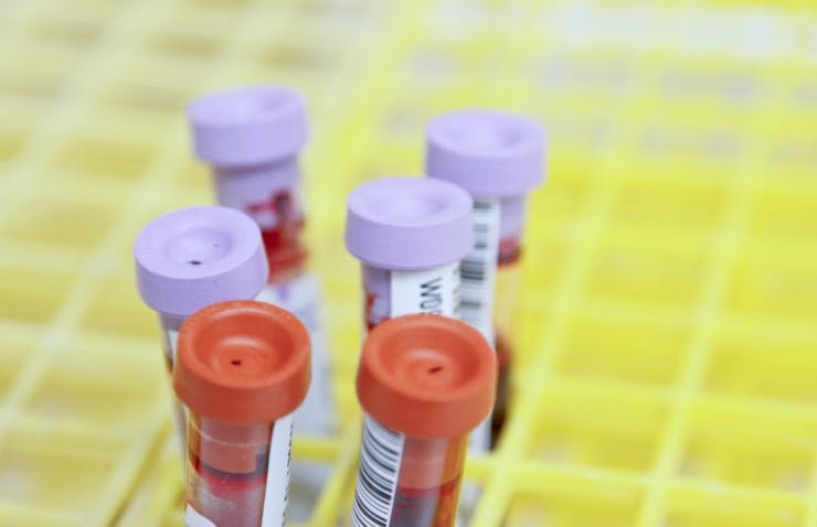 University of Washington Online Bloodborne Pathogen Training Course - Bloodborne Pathogens (BBP) for Researchers